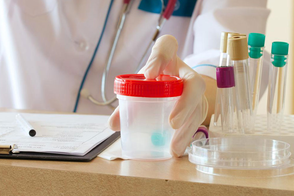 Proteinuria – The process of protein in urine test